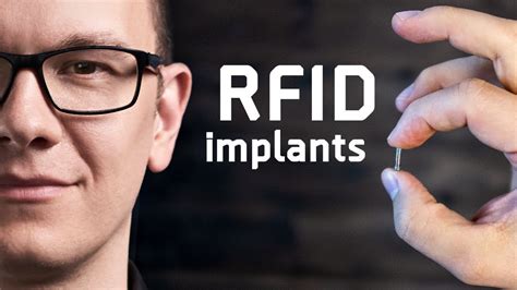 how to get rfid implanted